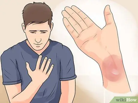 Распознайте симптомы артрита, шаг 2