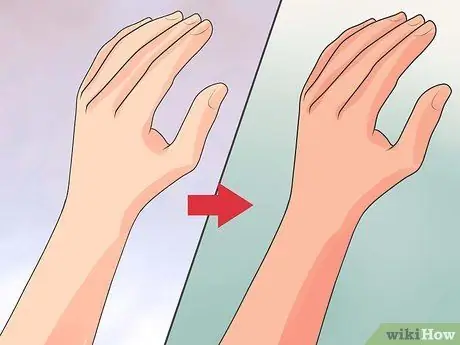 Распознайте симптомы артрита Шаг 8