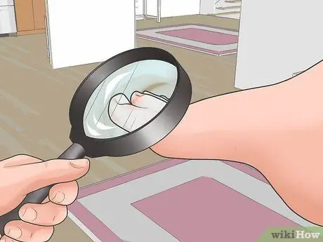 Безболезненно удалить занозу Шаг 1