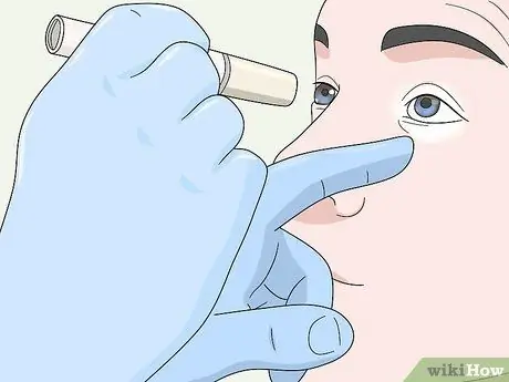 Вылечить двоение в глазах, шаг 3