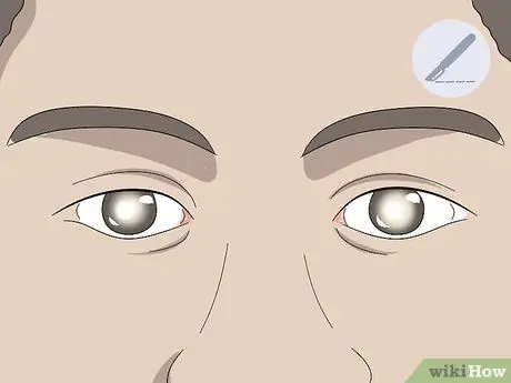 Вылечить двоение в глазах, шаг 6