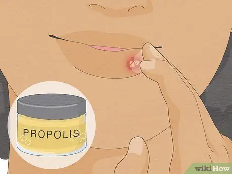 Быстрое избавление от герпеса, шаг 10