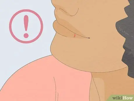 Быстрое избавление от герпеса, шаг 14