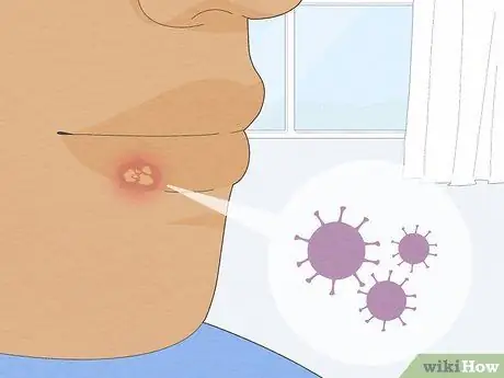 Быстрое избавление от герпеса, шаг 18