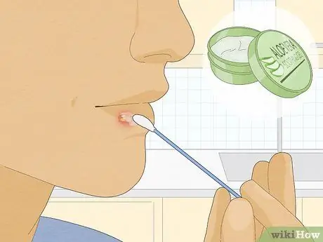 Быстрое избавление от герпеса, шаг 6