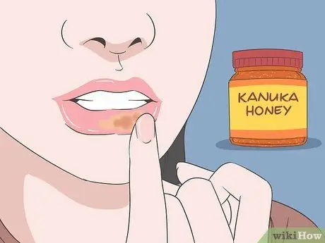 Избавьтесь от герпеса с помощью домашних средств, шаг 1