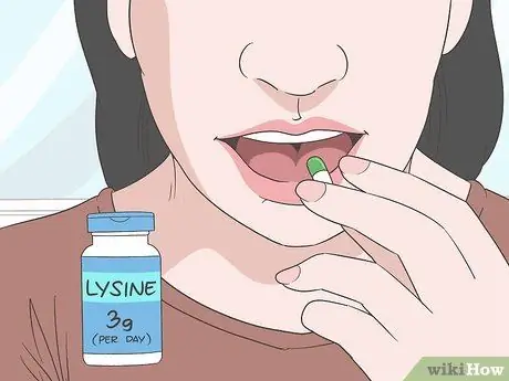 Избавьтесь от герпеса с помощью домашних средств, шаг 7