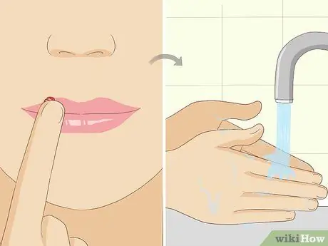 Вылечить герпес естественным путем Шаг 11