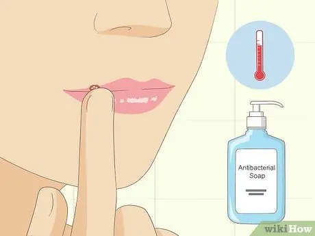 Вылечить герпес естественным путем, шаг 2