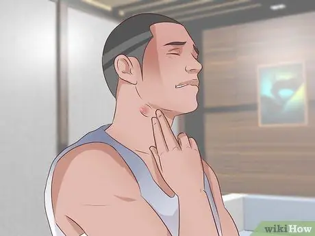 Как узнать, есть ли у вас герпес Шаг 2