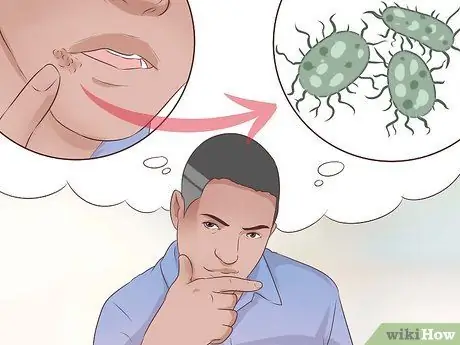 Как определить, есть ли у вас герпес Шаг 5