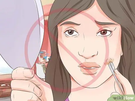 Как определить, есть ли у вас герпес Шаг 7