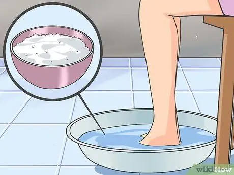 Лечить невропатию стоп Шаг 2