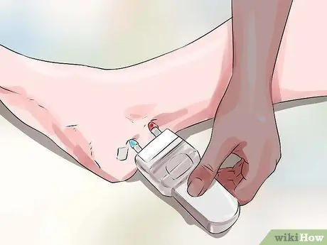 Узнайте, есть ли у вас невропатия в ногах Шаг 8