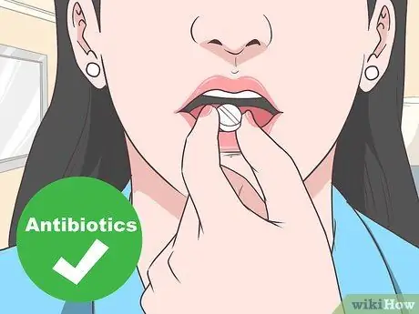 Лечить миокардит Шаг 6