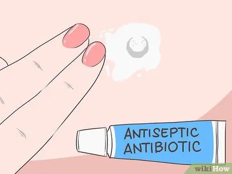 Как остановить кровотечение у родинки Шаг 3