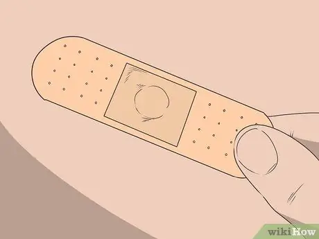 Как остановить кровотечение у родинки Шаг 4