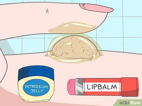 Как остановить кровотечение у родинки Шаг 5