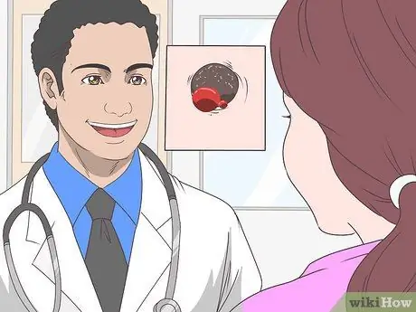 Как остановить кровотечение у родинки Шаг 7