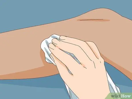 Остановить кровотечение при приеме разбавителей крови Шаг 6