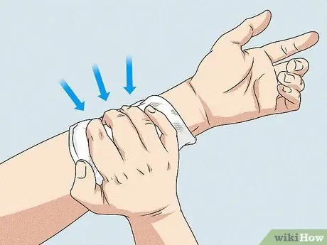 Остановить артериальное кровотечение Шаг 4