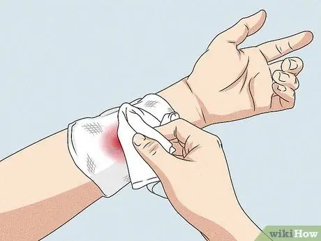 Остановить артериальное кровотечение Шаг 5