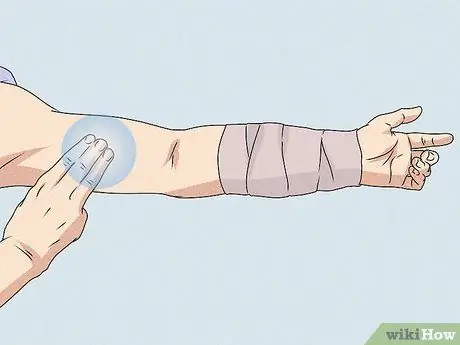 Остановить артериальное кровотечение Шаг 8