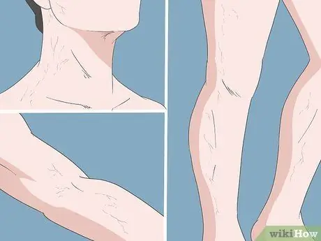 Определите разницу между артериями и венами Шаг 1