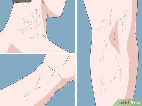 Определите разницу между артериями и венами Шаг 2