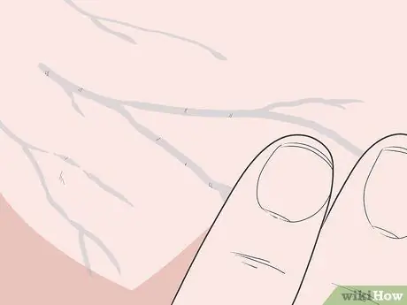 Определите разницу между артериями и венами Шаг 3