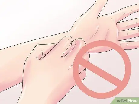 Лечить нервную боль, вызванную опоясывающим лишаем Шаг 1