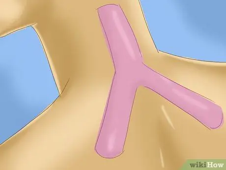 Используйте кинезиотейпы для снятия боли в шее Шаг 6