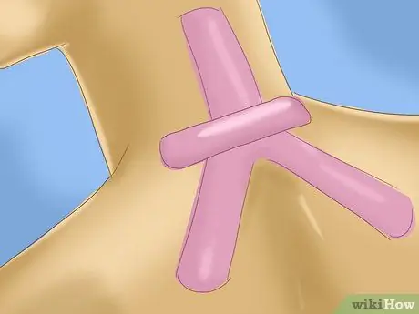 Использование кинезиологических лент для снятия боли в шее Шаг 7