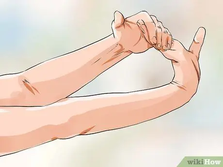 Лечить синдром запястного канала Шаг 2