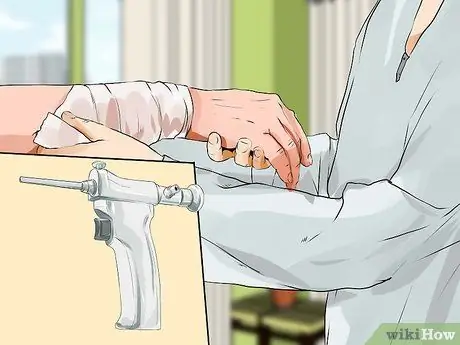 Лечить синдром запястного канала Шаг 10