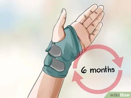 Лечить синдром запястного канала Шаг 11