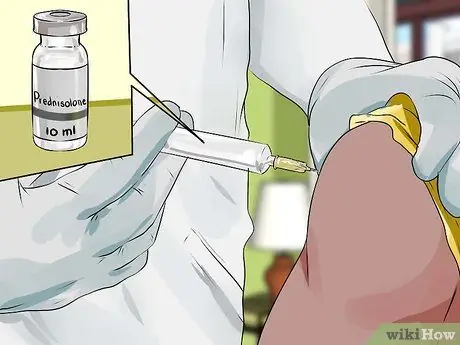 Лечить синдром запястного канала Шаг 9