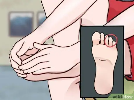 Сон с синдромом запястного канала во время беременности Шаг 10