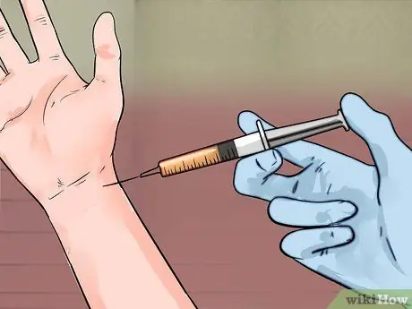 Сон с синдромом запястного канала во время беременности Шаг 11