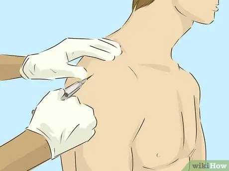 Исцеление от разрыва вращающей манжеты, шаг 6