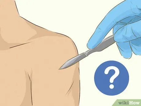 Исцеление от разрыва вращающей манжеты, шаг 7