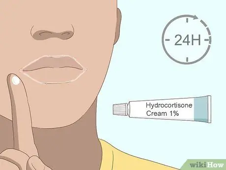 Вылечить угловой хейлит Шаг 10