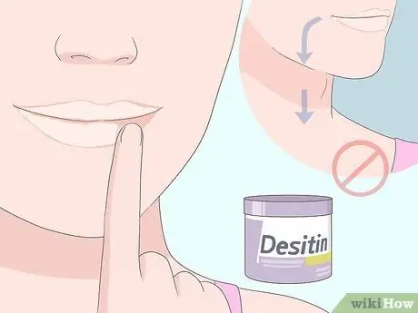 Вылечить угловой хейлит, шаг 4