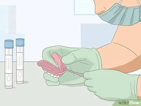 Вылечить угловой хейлит, шаг 7