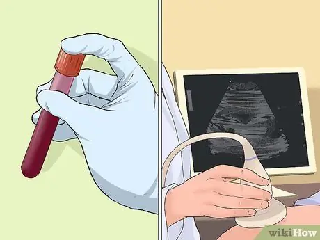 Тест на синдром Дауна, шаг 2