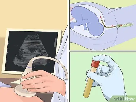 Тест на синдром Дауна, шаг 7