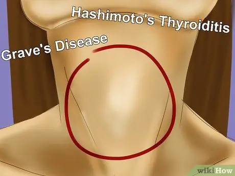 Прочтите результаты теста щитовидной железы, шаг 10