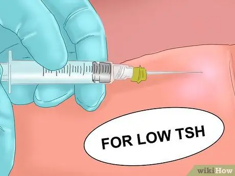 Прочтите результаты теста щитовидной железы, шаг 4