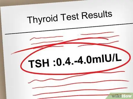 Прочтите результаты теста щитовидной железы, шаг 6
