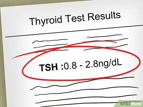 Прочтите результаты теста щитовидной железы, шаг 7